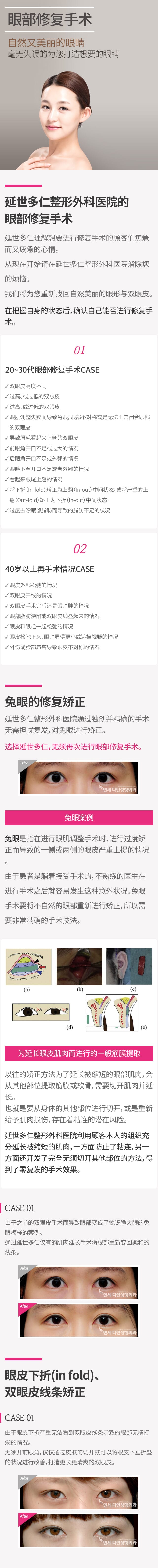 눈재수술