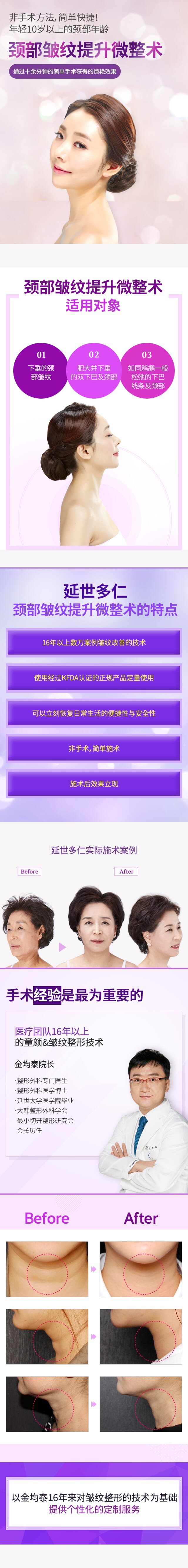 쁘띠목거상술
